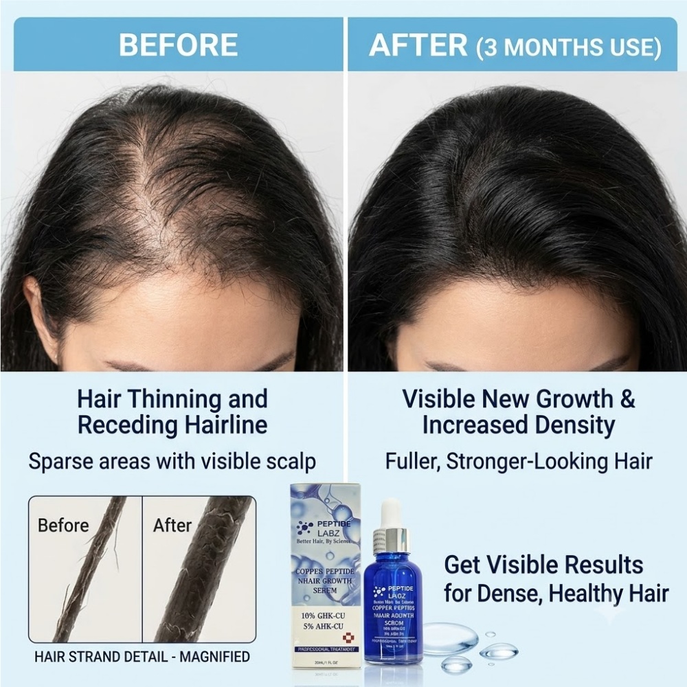 Esencia para el Crecimiento de - Hair Care Lotion reseña y precio